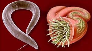 Wie kann man parasiten im körper erkennen? Parasiten Im Menschlichen Korper Erkennen Und Sicherer Schutz