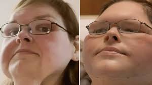 1000-lb Sisters' Tammy Slaton reveals major skin removal transformation
