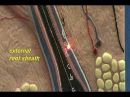 Inflamed hair follicle can appear anywhere on the skin with the exception of the palms of the hand and soles of the feet. Simple Skin Model Hair Follicle Youtube