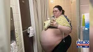 Jacksonville 20-year-old gets a second chance at life after having a  104-pound ovarian tumor removed – Action News Jax