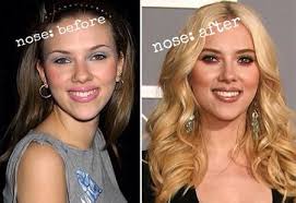 Scarlett Johansson Pretty By Plastic Surgery Nose Job Celebrities Before And After Hair Implants