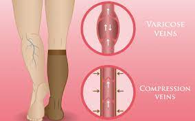 3 Ways Compression Socks And Stockings Help Nurses Mother Nurse Love