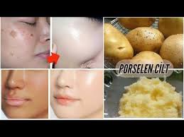 Uygula Gor Aninda Yuz Beyazlatma Mucize Beyazlatici Leke Acici Porselen Cilt Maskesi Guzellik Youtube Guzellik Yuzler Makyaj Fikirleri