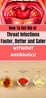 Unlike Over The Counter Antibiotics Natural Remedies Are Effective And Don T Cause Any Adverse Side Throat Infection Holistic Health Remedies Health Remedies