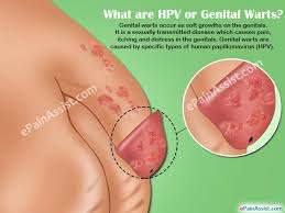 Tests for men most hpv infections in men are evidenced by the appearance of one or more warts on the penis, scrotum, thighs, groin, or anus. Hpv Or Genital Warts Symptoms Causes Treatment Prevention Complications Risk Factors Diagnosis