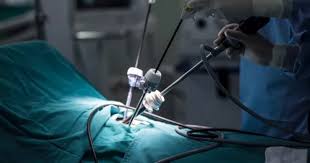 Laparoscopic surgery in the operating room with instruments and surgical drapes