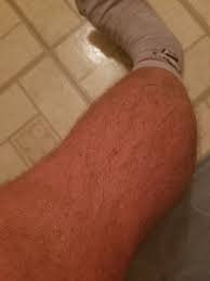 If you just shaved it i would not worry that it won't grow back. Does Leg Hair Grow In Multiple Directions Quora