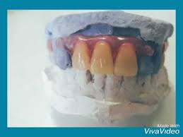 We did not find results for: Gigi Palsu Valplast Lentur Murah Hp Wa 0878 5225 2254 Youtube