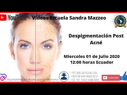 Despigmentación Post Acné
