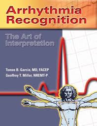 Arrhythmias The Art Of Interpretation Amazon Co Uk Tomas