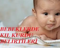 Bebeklerde Kil Kurdu Neden Olur Belirtileri Ve Tedavisi Saglik Haberleri