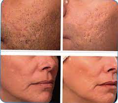 ما... - مركز بيوتي هير للتجميل وزراعة الشعر - قسم التجميل | Facebook