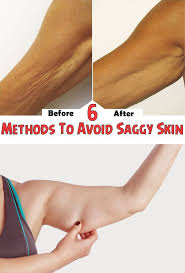 6 Methods To Avoid Saggy Skin Saggy Skin Health And Beauty Skin