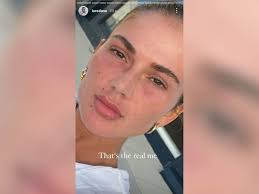 €* jul 5, 1994 in emmerich.facts and data. Loredana Ganz Naturlich Ungeschminkt Das Ist Mein Wahres Ich Bunte De