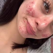 Happy heavenly 100th birthday to Richard Scott Ballou. Born 12/25/23 to  4/23/83.