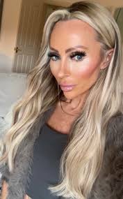 Skin Repair Season is now to get GLOWING for the holidays! Get a bonus  Dermaplane & all the goodness of Vitamins, Aminoacids, Minerals, hyaluronic  acid & PDRN (salmon sp3rm) with our Vamp