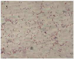 Image result for Clostridium