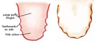 Sep 10, 2019 · symptoms of thyroid cancer include swollen lymph nodes, pain in the throat, difficulty swallowing, hoarseness, and a lump near the adam's apple. Pin On Chinese Pressure Points