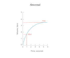 Spirometry Procedure Normal Values And Test Results