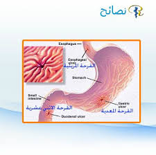 1,694 likes · 49 talking about this · 1,087 were here. Ù‚Ø±Ø­Ø© Ø§Ù„Ù…Ø¹Ø¯Ø© Ù…Ø¹Ù†Ù‰ Ù‚Ø±Ø­Ø© Ø§Ù„Ù…Ø¹Ø¯Ø© ÙˆØ§Ù„Ø§Ù…Ø¹Ø§Ø¡ Ù†Ù‚ØµØ¯ Ø¨Ø§Ù„Ù‚Ø±Ø­Ø© Ø§Ù„Ù…Ø¹Ø¯ÙŠØ© ÙˆØ§Ù„Ù…Ø¹ÙˆÙŠØ© Ø­Ø¯ÙˆØ« ØªØ¢ÙƒÙ„ Ù…ÙˆØ¶Ø¹ÙŠ ÙÙŠ Ø§Ù„ØºØ´Ø§Ø¡ Ø§Ù„Ù…Ø®Ø§Ø·ÙŠ Ù„ Health Blogger Gastrointestinal Bleeding Health Blog