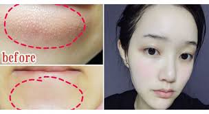 Pin On Skincare