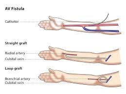 Pin On Vascular