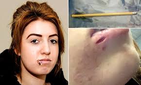 Beauty student, 17, is shot in the FACE with 4in crossbow bolt