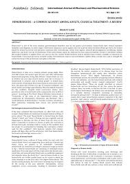 pdf hemorrhoids a common ailment among adults causes