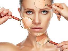 6 Home Remedies To Remove Burn Marks From The Skin - Boldsky.com