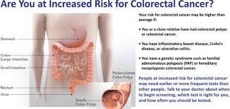 According to the american cancer society, about 1 in 24 women and 1 in 22 men have a lifetime risk of developing colon cancer ( source ). How Long Does Colon Cancer Take To Develop Develop Public Health