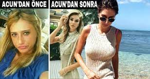 Şeyma subaşı'nın mikonos adasına lüx yatla gidişi anka. Seyma Subasi Eski Fotografina Acun Dan Once Yorumu Yapilinca Cilgina Dondu Son Dakika Magazin