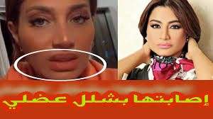 بسمة وهبة في أول لقاء بعد إصابتها بالسرطان للمرة الثانية. Ø£ØµØ§Ø¨Ø© Ø§Ù„Ø£Ø¹Ù„Ø§Ù…ÙŠØ© Ø¨Ø³Ù…Ø© ÙˆÙ‡Ø¨Ù‡ Ø¨Ø´Ù„Ù„ ÙÙŠ Ø§Ù„ÙˆØ¬Ù‡ ÙˆØ§Ù„ÙÙƒ Ø¨Ø³Ø¨Ø¨ Ø¹Ù…Ù„ÙŠØ© ØªØ¬Ù…ÙŠÙ„ ÙØ§Ø´Ù„Ø© Ø§Ù„ØªÙØ§ØµÙŠÙ„ ØµØ§Ø§Ø§Ø¯Ù…Ø© Youtube