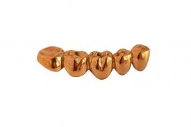 Check spelling or type a new query. What We Buy Dental Gold California Gold And Silver Exchange