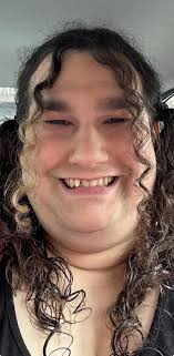 What would I look like with perfect teeth and smile?