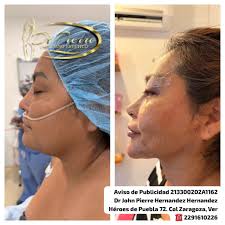 DrJohn Pierre Hernandez Hernandez (@drpierreffect) • Instagram photos and  videos