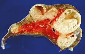 Image result for Rhodococcus equi