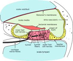 sensorineural hearing loss wikipedia