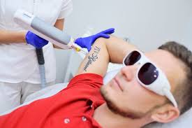 Delivered over 25,000 botox treatments. A Guide To Laser Tattoo Removal San Diego Dermatologist