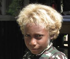 Furthermore, blonde hair is very common among these people even though they have dark skin. Another Genetic Quirk Of The Solomon Islands Blond Hair The New York Times