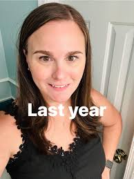 Hi everyone! I am about a month before surgery. My biggest fear is hair  loss. Is there anything I can do now to help with this issue. Otherwise I  am so excited