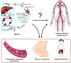 If your blood pressure is too high, it puts extra strain on your blood vessels, heart and other organs, such as the brain, kidneys and eyes. The Malaria High Blood Pressure Hypothesis Circulation Research