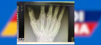 So there is a huge gap to bridge. Gold Coast 2018 Ezuan Retak Jari Tangan Stadium Astro