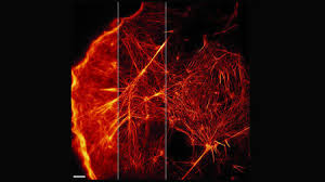 Are you looking to strike off a company in indonesia?. Superresolution Microscopy Science Aaas