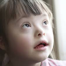 Down is niet altijd alleen maar lijden