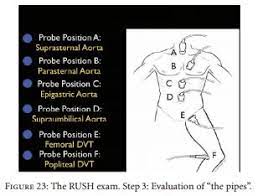 Craig sisson, ultrasound director at uthscsa in san antonio, tx for. The Best Article On The Rush Ultrasound Exam For Medical Shock Tom Wade Md