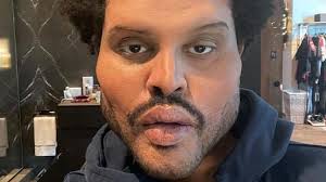 The weeknd is a canadian singer, songwriter and record producer. The Weeknd Aparece Com Rosto Deformado Em Clipe E Internautas Apontam Referencias Ao Grammy Verso Diario Do Nordeste