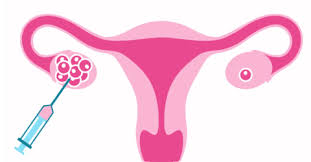 Therefore, it is important that each patient. Egg Retrieval Life Ivf Center