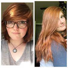 Physical stability, hair growth activity on rats, and safety test. 1 Year 4 Months Of Gingery Hair Growth Hair