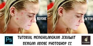 Nah, sebelumnya kita sudah mempelajari cara menghilangkan bintik hitam di wajah. Cara Mudah Menghilangkan Jerawat Di Photoshop Cc Ya Gampang