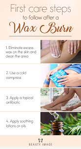 How To Treat Wax Burns On Face Waxing Tips Wax Hair Removal Facial Tips